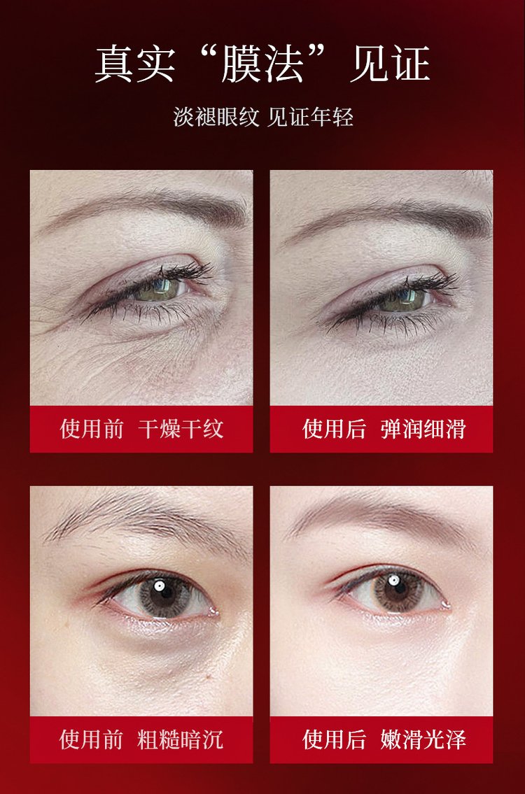 韩伦美羽黄金窝蜂蝴蝶眼膜贴改善黑眼圈眼袋眼纹细纹鱼尾纹玻尿酸_b568ea12.jpg