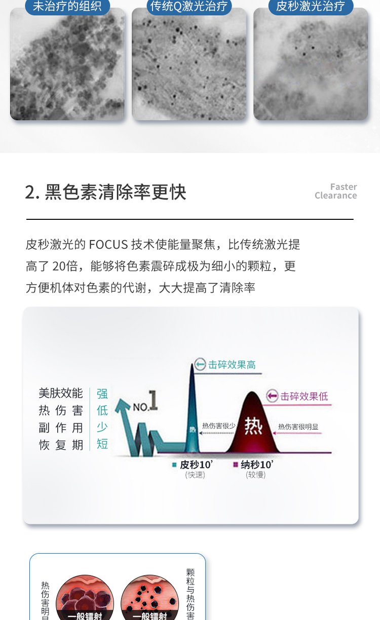 卡尺窄脉宽祛斑王台式激光去斑点痣去痘印色素沉淀美白嫩肤_a6a19301.jpg