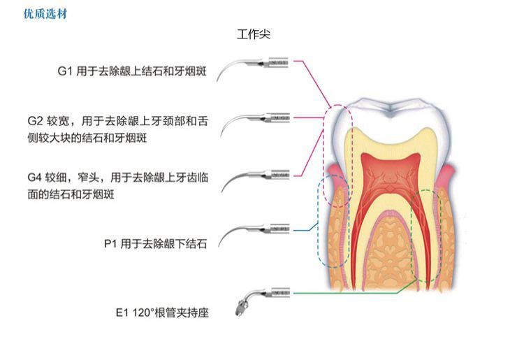 维润洗牙机器超声洁牙机VR-K08A牙周治疗仪口腔牙科诊所医用洁_43d738f9.jpg