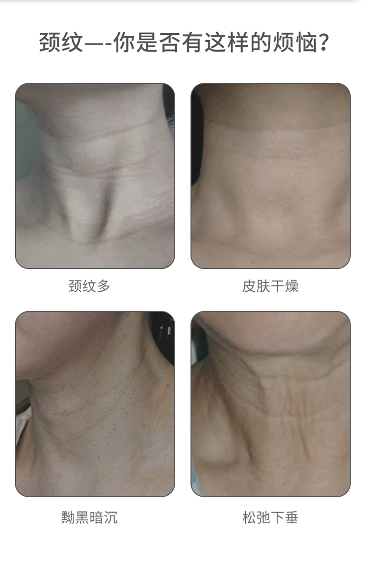 去颈纹淡化法令纹美容美颈仪脸部彩光导入按摩仪器颈部护理瘦脸仪_5a324dc7.jpg